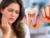 My Root Canal Tooth Still Hurts: 7 Possible Reasons You Shouldn't Ignore