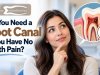 Do You Need a Root Canal If You Have No Tooth Pain?