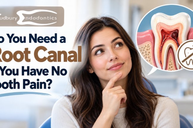 Do You Need a Root Canal If You Have No Tooth Pain?