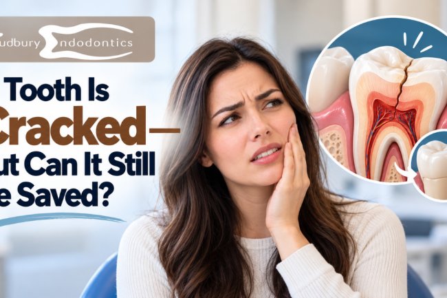 A Tooth Is Cracked—but Can It Still Be Saved?